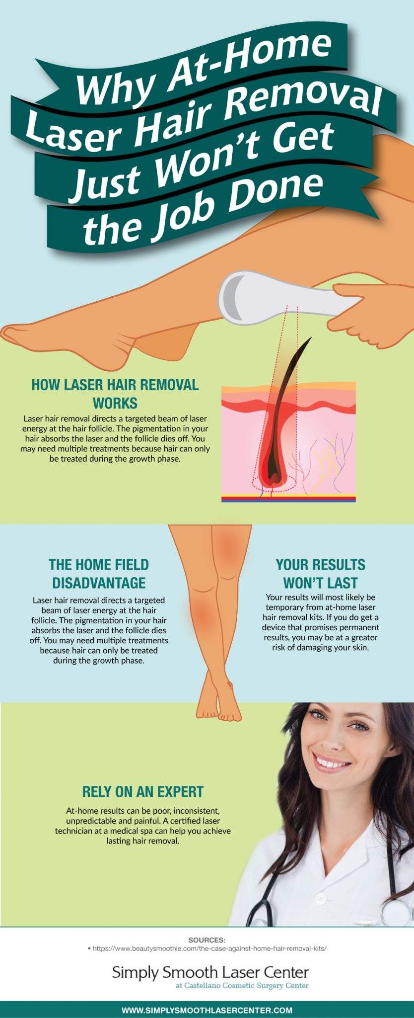 laser hair removal infographic