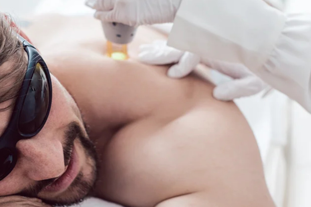 man getting laser treatment